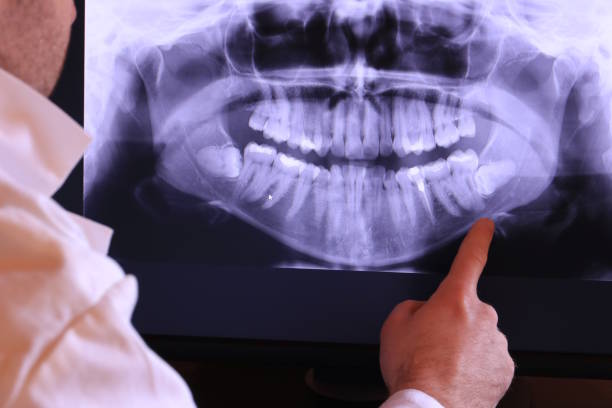 Best Emergency Denture Repair in Seaford, NY