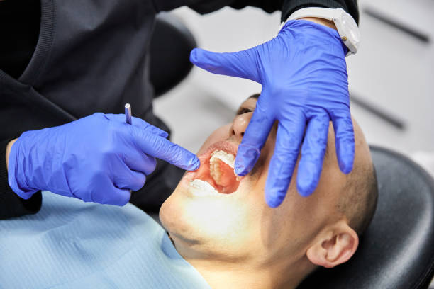 Best Emergency Dental Care for Broken or Chipped Teeth in Seaford, NY